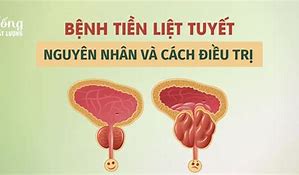 Tăng Sản Xuất Tuyến Tiền Liệt Là Gì